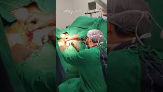 Laser Piles and Fissure Surgery #trending #viral #reels #doctor #india #piles #like #1000subscriber