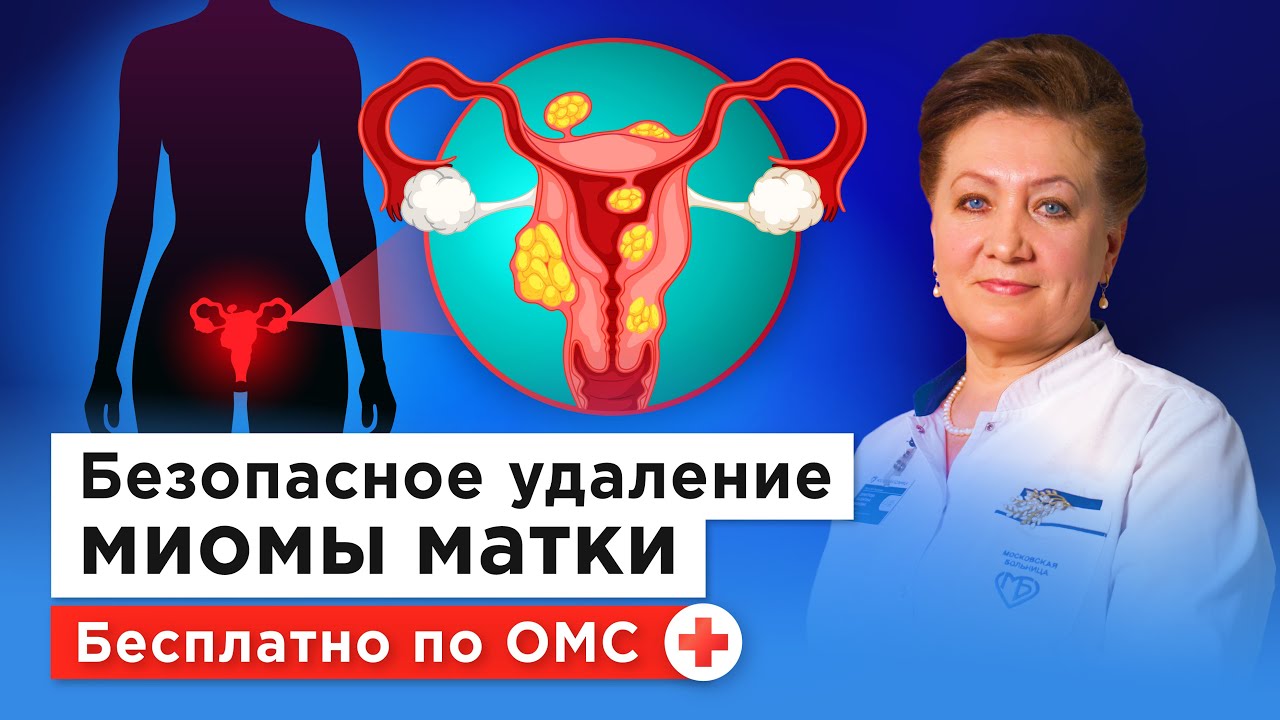 Как удалить миому, сохранив матку: эмболизация маточных артерий бесплатно по ОМС
