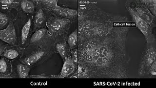 Nanolive imaging suggests cell-cell fusion could play a key role in the SARS-CoV-2 infection process