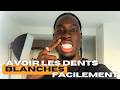 TU VEUX DES DENTS BLANCHES EN TANT QUE RENOI ? COMMENCE PAR ÇA (99% FONT MAL)