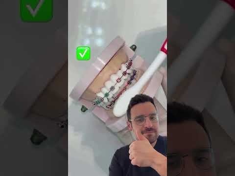 Brossage optimal avec