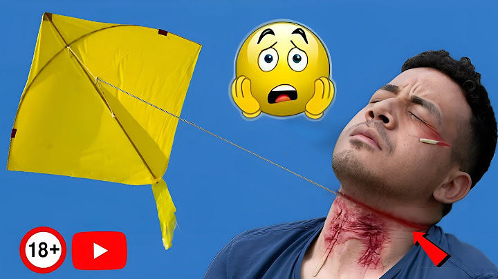 Painful incidents caused by kite strings 😨 | Kite Flying