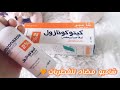 علاج فطريات الشعر القشرية القشرة من أول مرة و تجربتي معاها 
