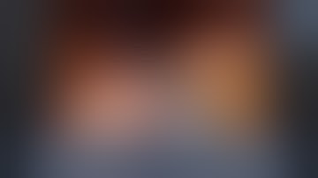 The New Robotic SF 60 Stapling Device