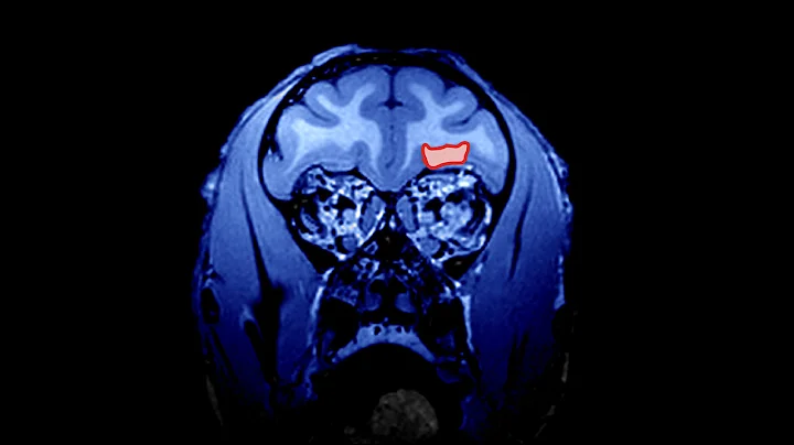 Understanding the Science of Curiosity