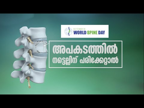 അപകടത്തിൽ  നട്ടെല്ലിന് പരിക്കേറ്റാൽ | Handle Spinal Injury | Malayalam