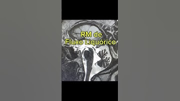 RM de Fluxo Liquórico