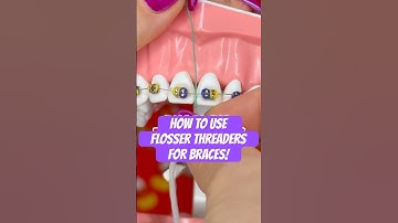 HOW TO USE FLOSS THREADERS FOR BRACES 🦷 #braces #howto #teeth