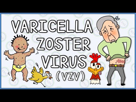 Video: Wanneer is varicella zoster aansteeklik?