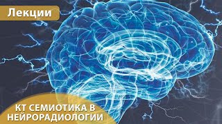 Часть 1. КТ семиотика в нейрорадиологии. Андрей Мангов