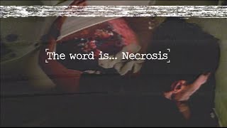 THIS SONG IS BEATBOXING! I "Got That Neco-Rosis" a song by a beatboxer using the word "necrosis"