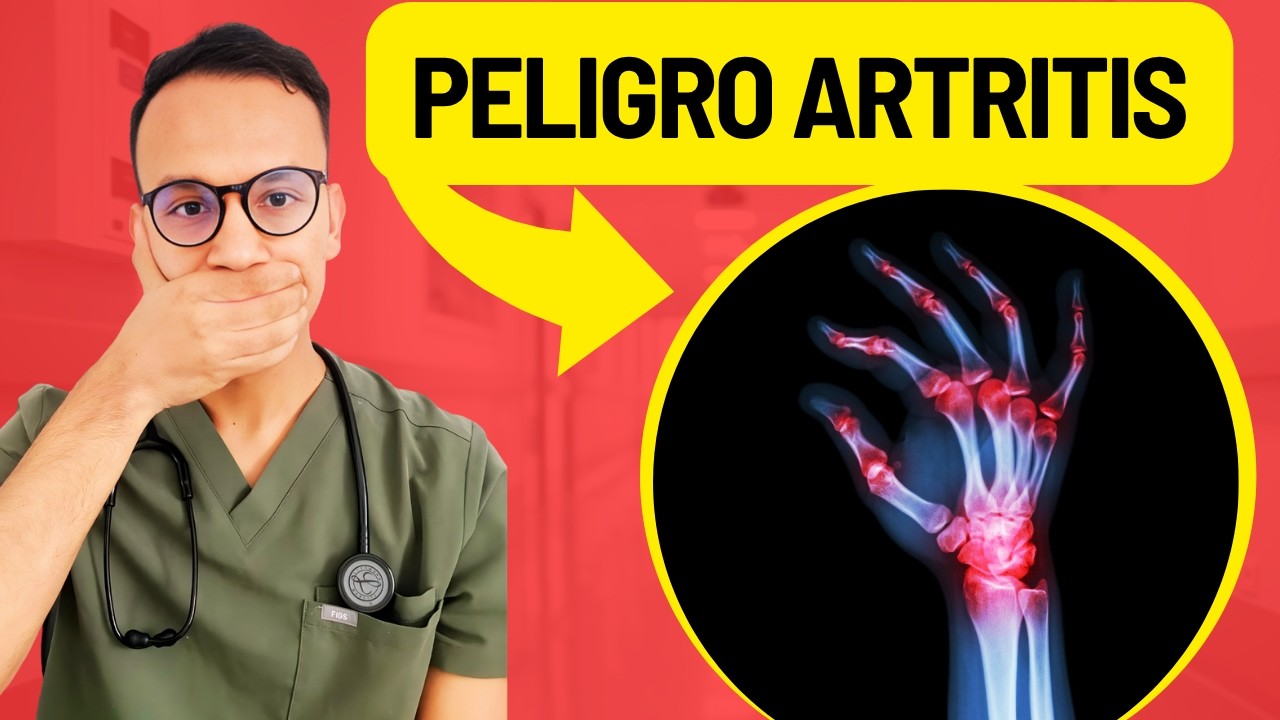 ¡LO QUE NADIE TE DICE sobre la ARTRITIS REUMATOIDE! Síntomas y Cómo Detectarlo a Tiempo