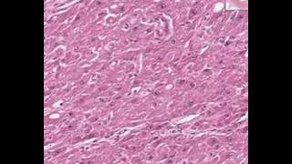 Shotgun Histology Corpus Luteum