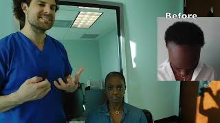 Natural Hair Transplant | Best Hair Transplant Surgeons