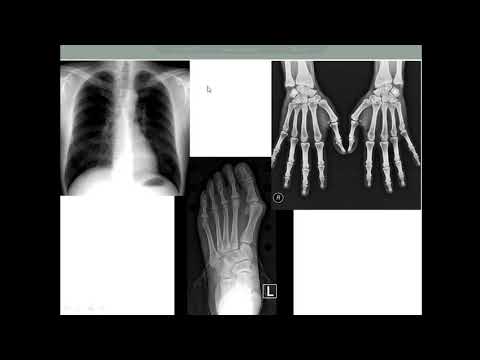 Video: Apa faktor yang mengatur kontras radiografi?