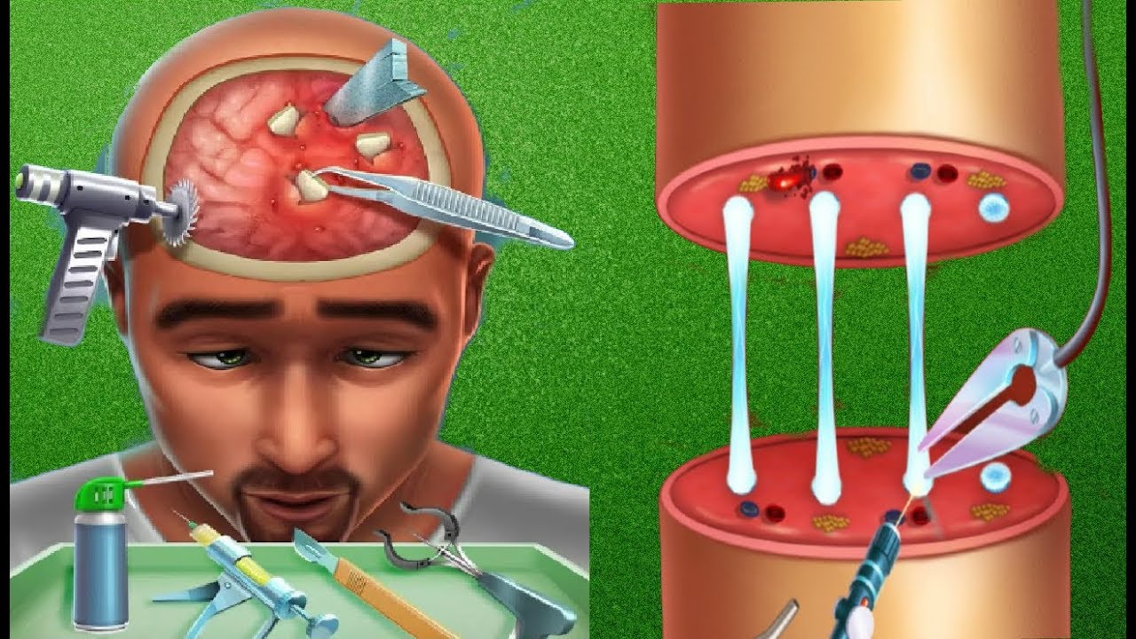 Brain Surgery Simulator Tornado Crisis Tabtale Brain Surgery Doctor