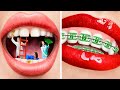 Si Mes Parents Étaient Dentistes ! 11 Situations Amusantes !