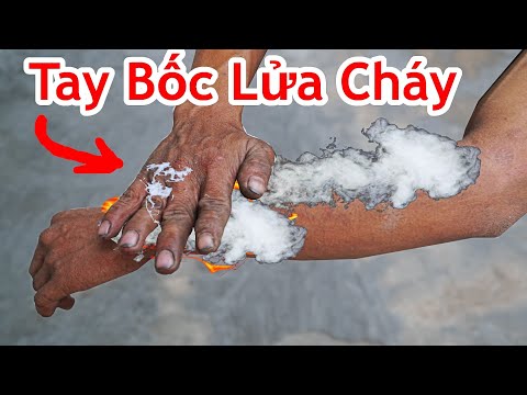 Khó Tin ! Cách Ma Sát Cánh Tay Bốc Cháy Cực Hay/ Mẹo Chà 2 Ngón Tay Bốc Khói Bằng Diêm.hands on fire