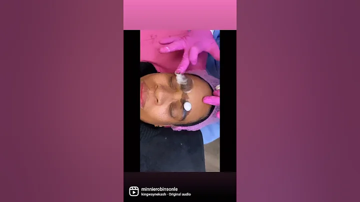Microshading results at Minnie Robinson Beauty Lou...
