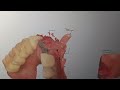Anbu laser dental clinic annanagar west extension, chennai,dental clinic,dentist