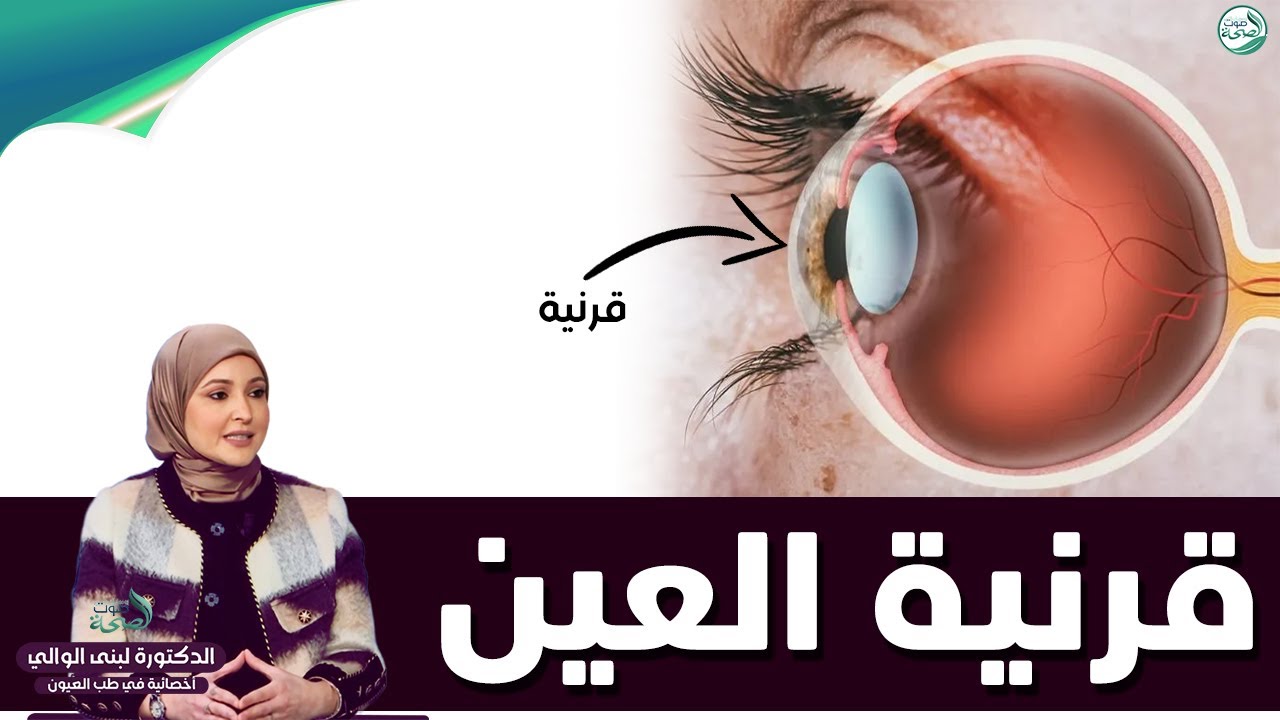 قرنية العين / القرنية المخروطية | د. لبنى الوالي أخصائية طب العيون