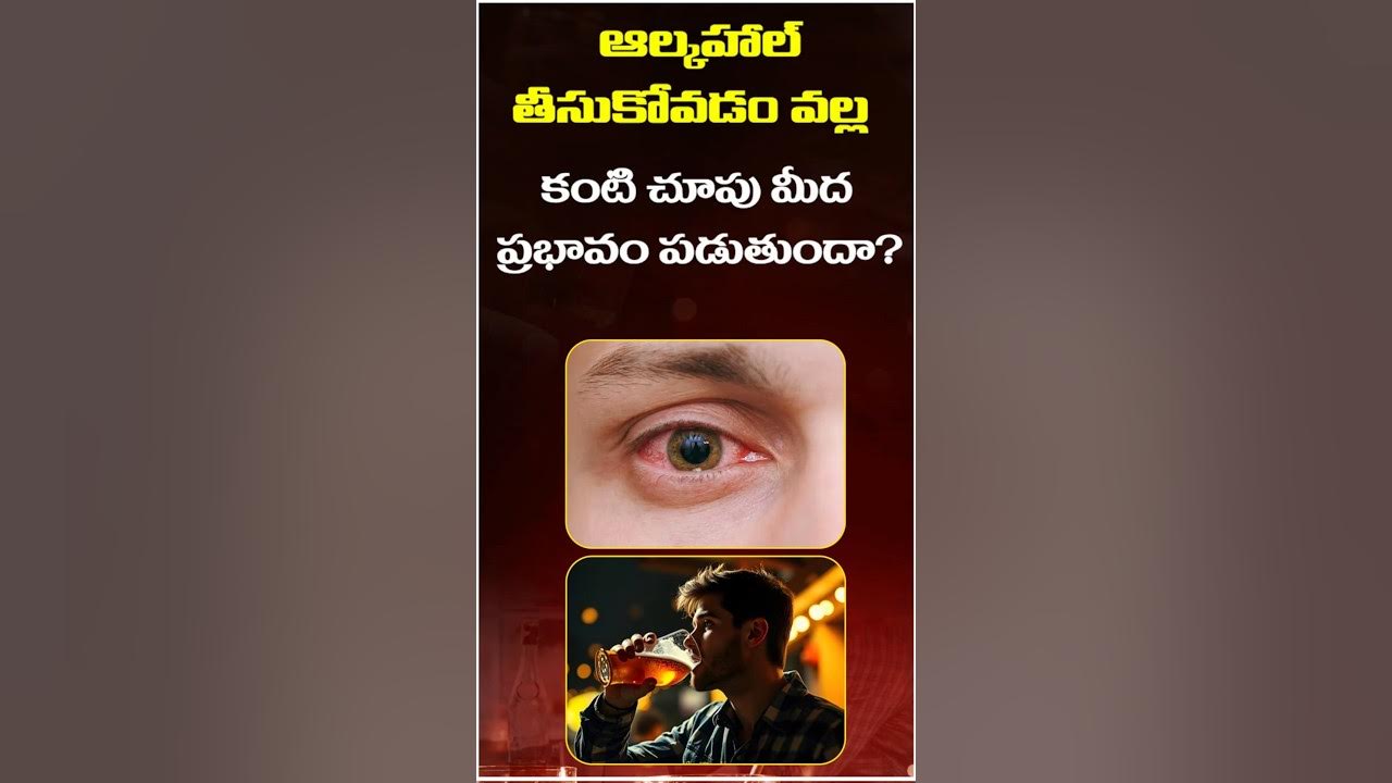 Is Alcohol Damage Your Eyes In Telugu Smartvision Eye Hospitals is-alcohol-damage-your-eyes-in-telugu-smartvision-eye-hospitals