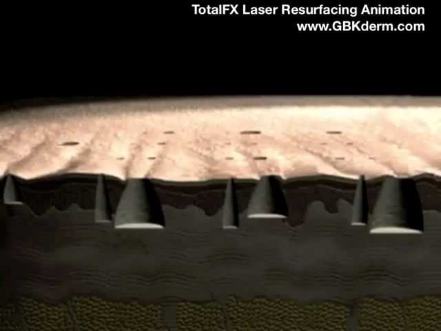 Banner for TotalFX Laser Animation