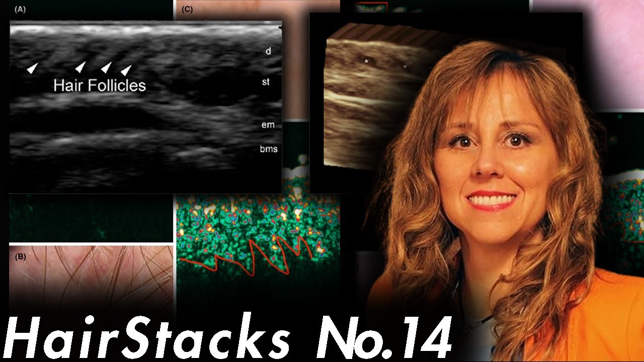 Hair Follicle & Skin Imaging with Dr. Ximena Wortsman | HairStacks No. 14