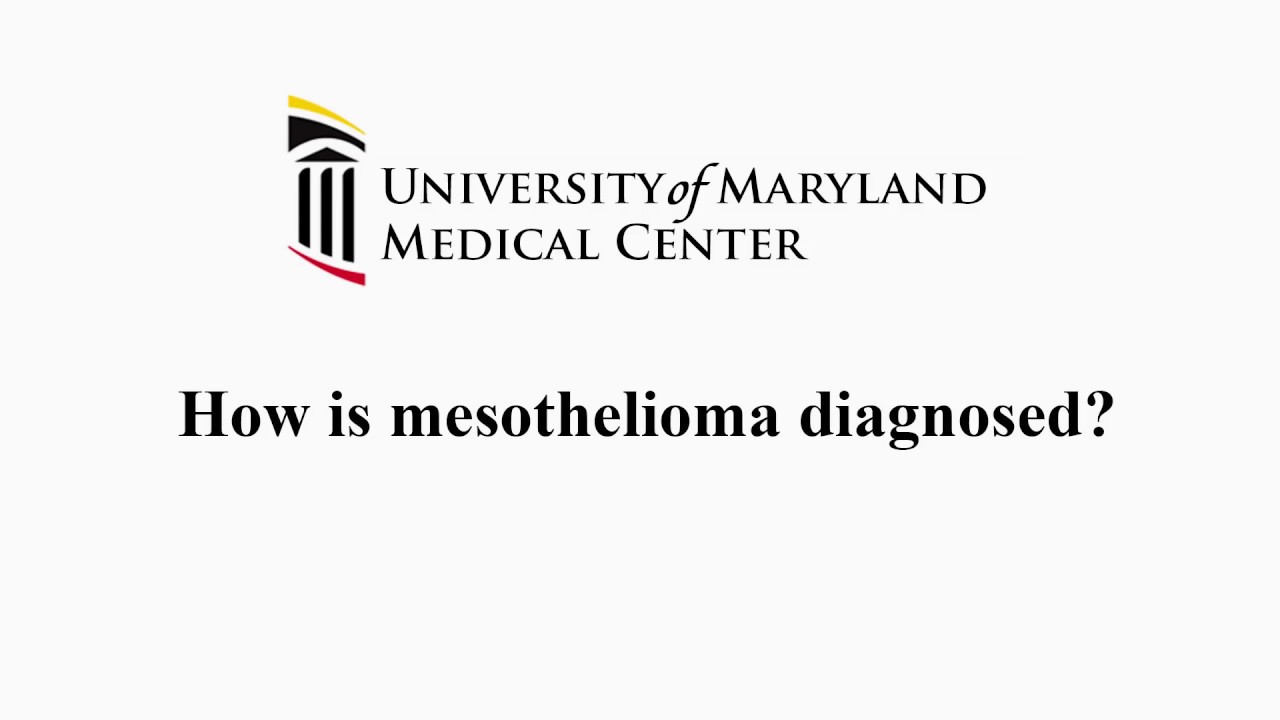 ovarian cancer causing pleural effusion