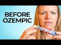 GLP-1 Weight Loss Injections vs. Metabolic Reset: A Doctor's Honest Breakdown