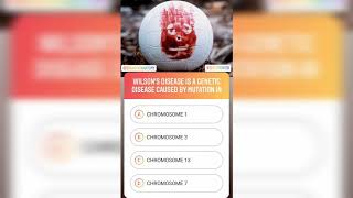 Question #128 | Brain Map Anatomy