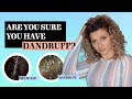 THE DIFFERENCE BETWEEN DANDRUFF VS DRY SCALP + TREATMENTS