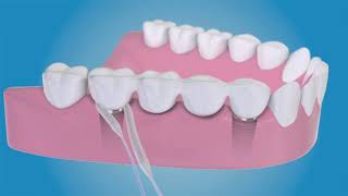 ProxySoft Dental Floss, A Demonstration screenshot 3