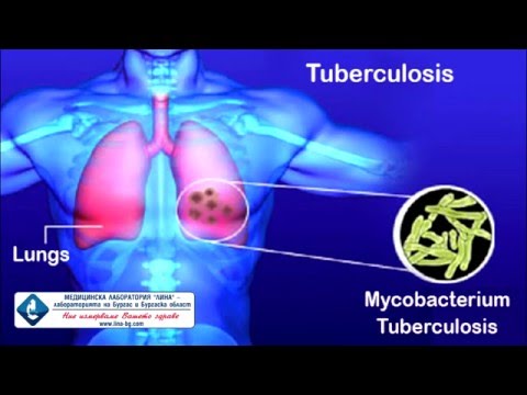 Video: Vrste Testov Za Tuberkulozo In Tuberkulozo