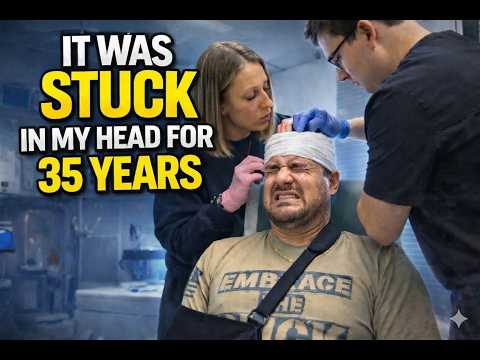 (graphic) I Got St@bbed In The Head - The Dr Had To Remove It