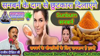 Sunburn ka ilaj in Hindi, हल्दी Turmeric for Beauty, sunburn, beauty tips, skin care, cosmetics