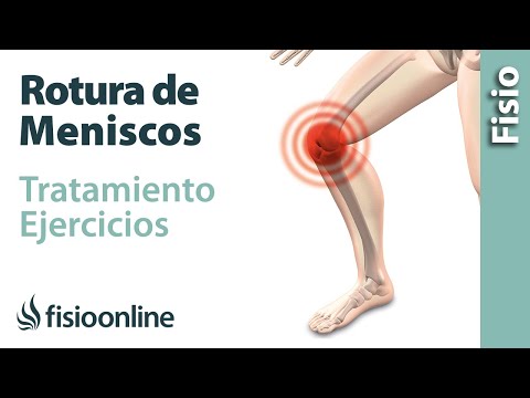 Vídeo: Lágrimas De Menisco: 8 Ejercicios Para Probar