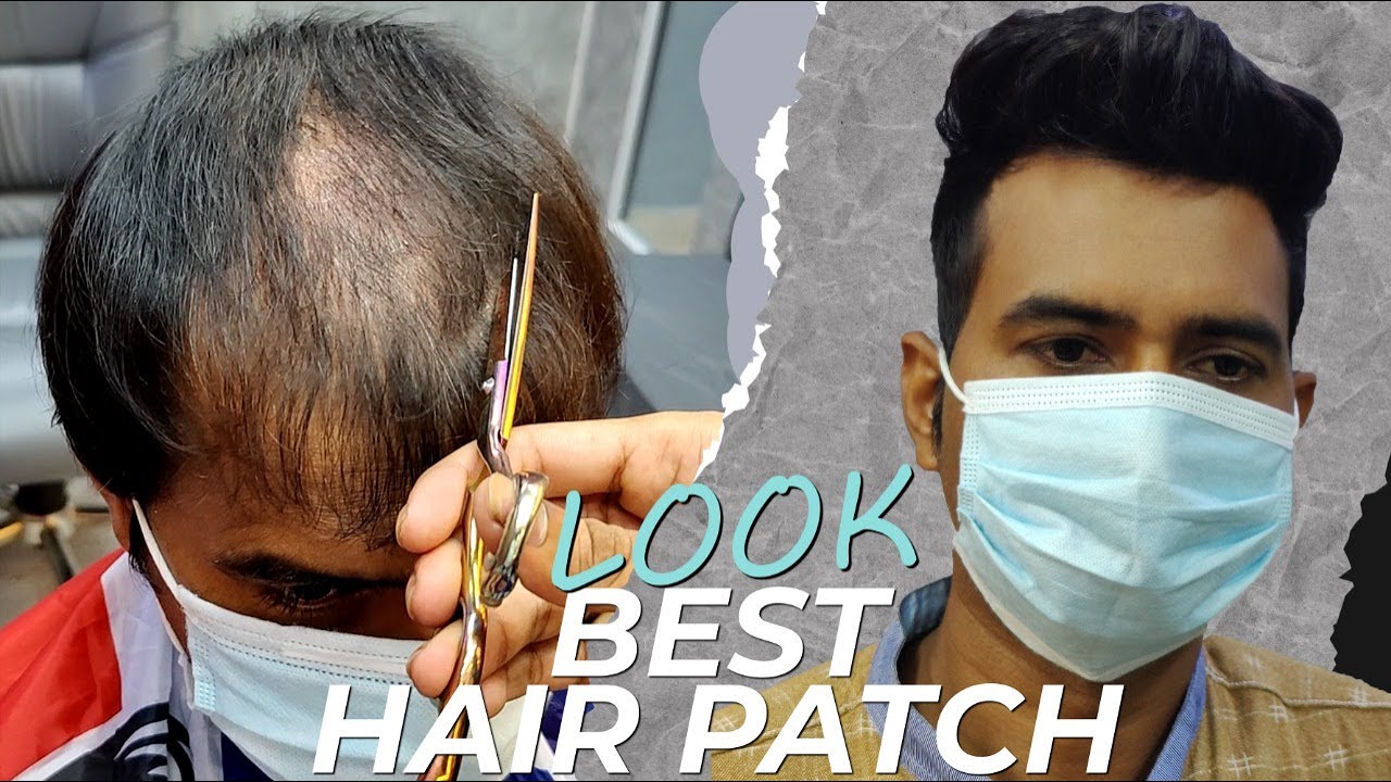 Hair Patch | non surgical hair replacement | permanent hair patch delhi -  YouTube
