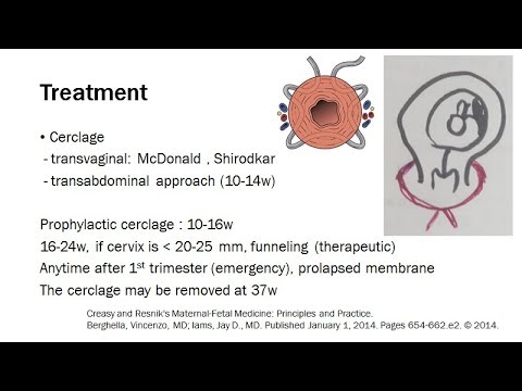 Video: Årsaker Til Tidlig Fødsel: Behandling For Inhabil Kompetanse I Livmorhalsen Health