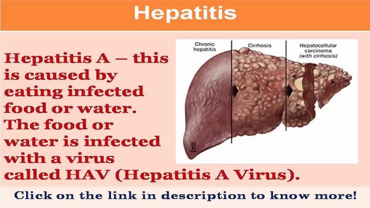 how to get infected with hepatitis b