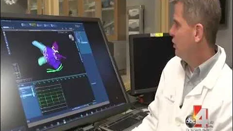 Afib Patients at Greater Risk for Dementia