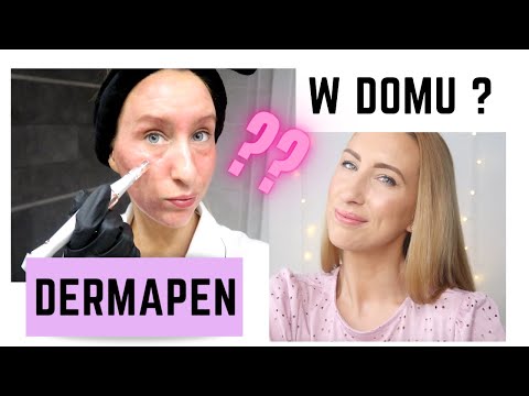 DERMAPEN - JAK WYKONAĆ ZABIEG W DOMU?😳 Co kupić - Pielęgnacja!  | Beautifly B- Meso