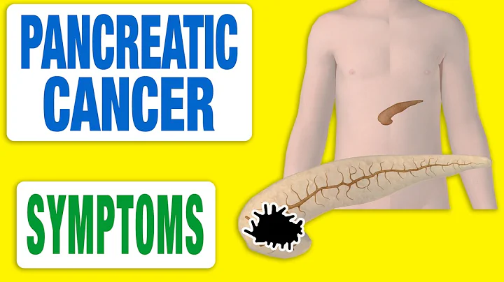 Pancreatic Cancer - All Symptoms - DayDayNews