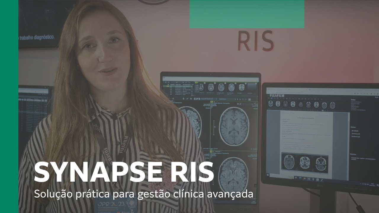 Synapse Ris SYNAPSE RIS: o sistema de gestão de informações radiológicas da ...