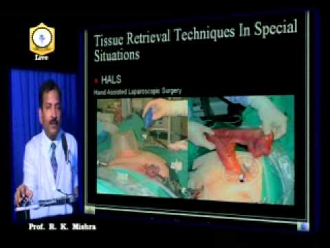 Dr R K Mishra delivering lecture on Laparoscopic Tissue Retrieval Technique Part I