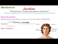 WHAT IS JAUNDICE? - SIMPLE EXPLANATION OF 3 MAIN CAUSES