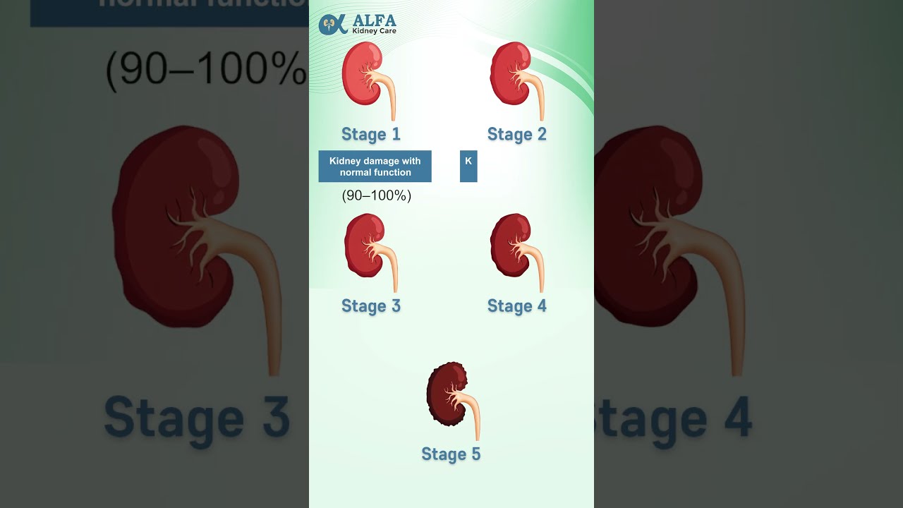 Do you know the 5 stages of Chronic Kidney Disease?