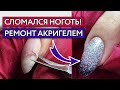 Как исправить сломанный ноготь? / Ремонт ногтя акригелем