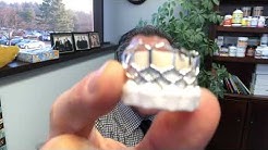 SAVR? TAVR? New Data