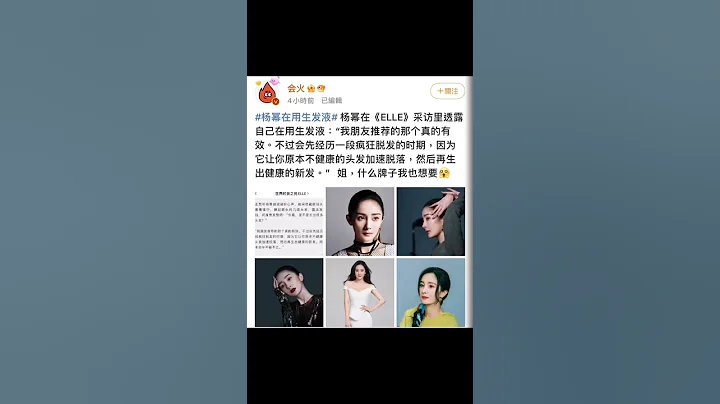 《楊冪在用生髮液》估計就是在使用「外用米諾地爾 Minoxidil」 - 天天要聞